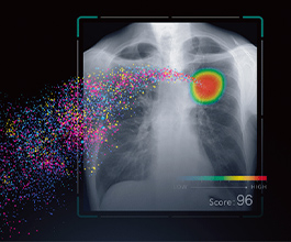 胸部X線画像病変検出ソフトウェア CXR-AID